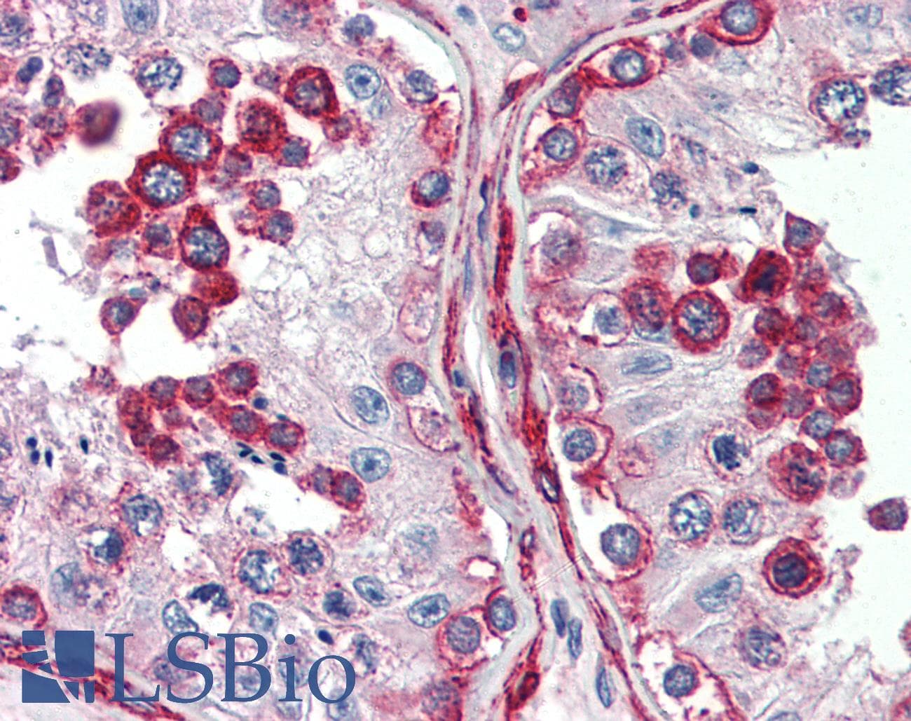 PathPlus™ DLG4 / PSD95 Antibody (C-Terminus)