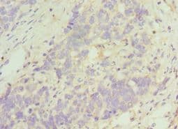 TACR3 / NK3R Antibody (aa356-465)