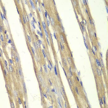 Polyclonal Rabbit anti-Human CASP7 / Caspase 7 Antibody (IHC, IF, WB)