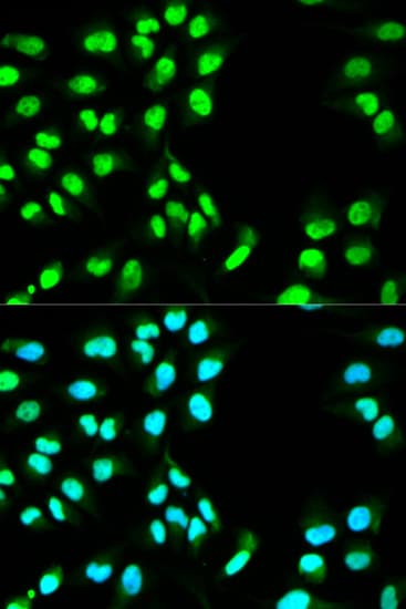 Polyclonal Rabbit anti-Human MCM3 Antibody (IHC, IF, WB)