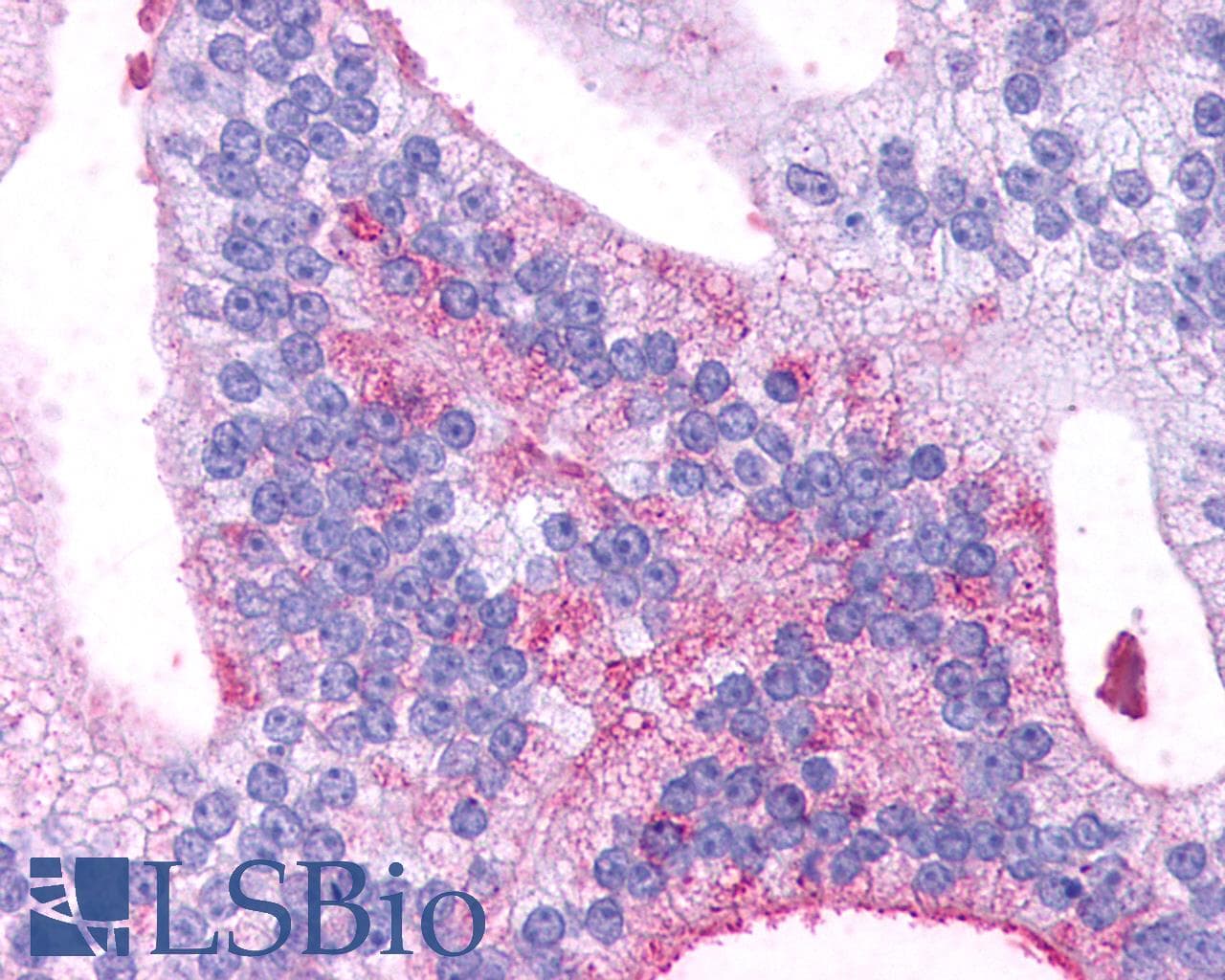 IHC-plus™ Polyclonal Rabbit anti-Human GPR88 Antibody (C-Terminus, IHC)