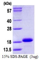 Human CYB5A / Cytochrome b5 Protein (Recombinant His)