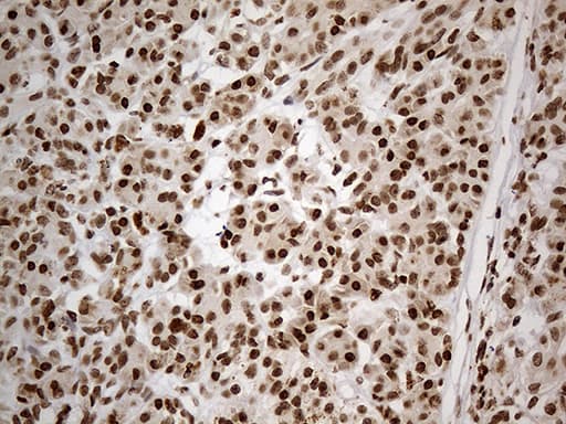 Monoclonal Mouse anti-Human CDC45 Antibody (clone OTI4F3, aa1-270, IHC, WB)