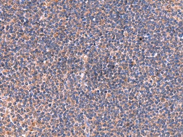 Polyclonal Rabbit anti-Human ISM1 Antibody (IHC, WB)