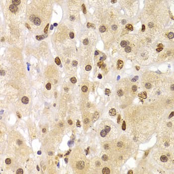 Polyclonal Rabbit anti-Human HNRPA1 / HnRNP A1 Antibody (IHC, IF, WB)