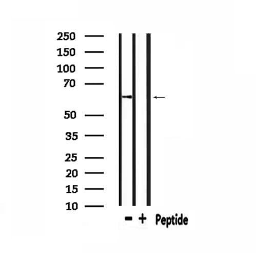 CALR / Calreticulin Antibody
