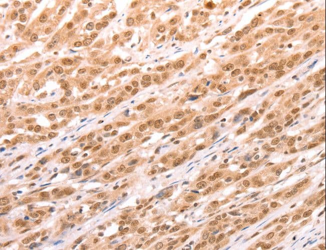 Polyclonal Rabbit anti-Human TAX1BP1 Antibody (IHC)