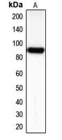 Polyclonal Rabbit anti-Human CDH16 / Cadherin 16 Antibody (C-Terminus, WB)