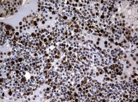 PCNA Antibody (clone OTI6B6)