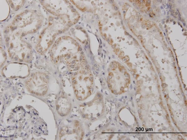 CLPP Antibody (clone 3E2)