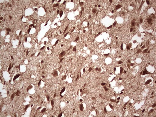 Monoclonal Mouse anti-Human NEFM / NF-M Antibody (clone OTI2G3, aa413-773, IHC, WB)
