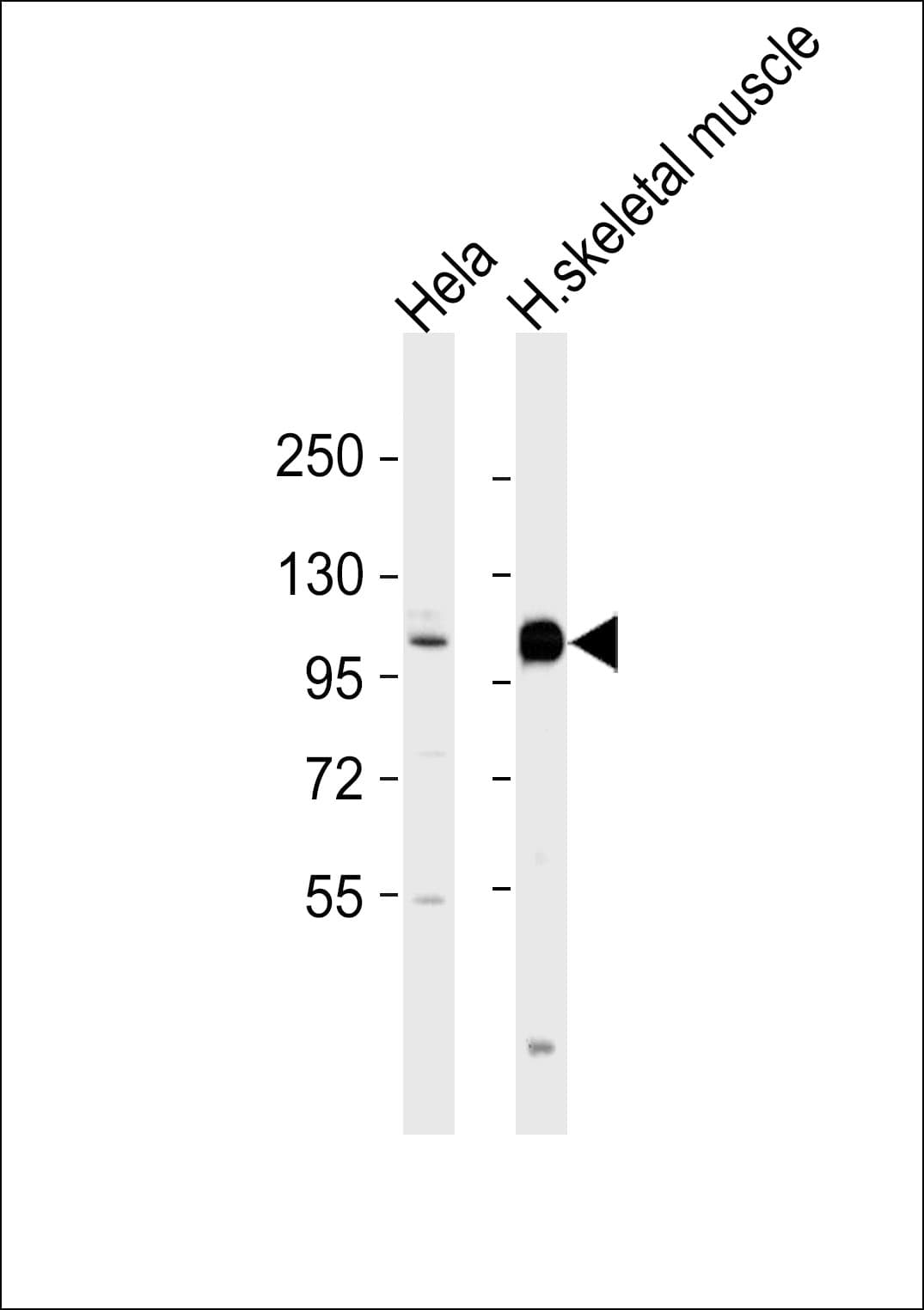 Polyclonal Rabbit anti-Human ACTN3 Antibody (WB)