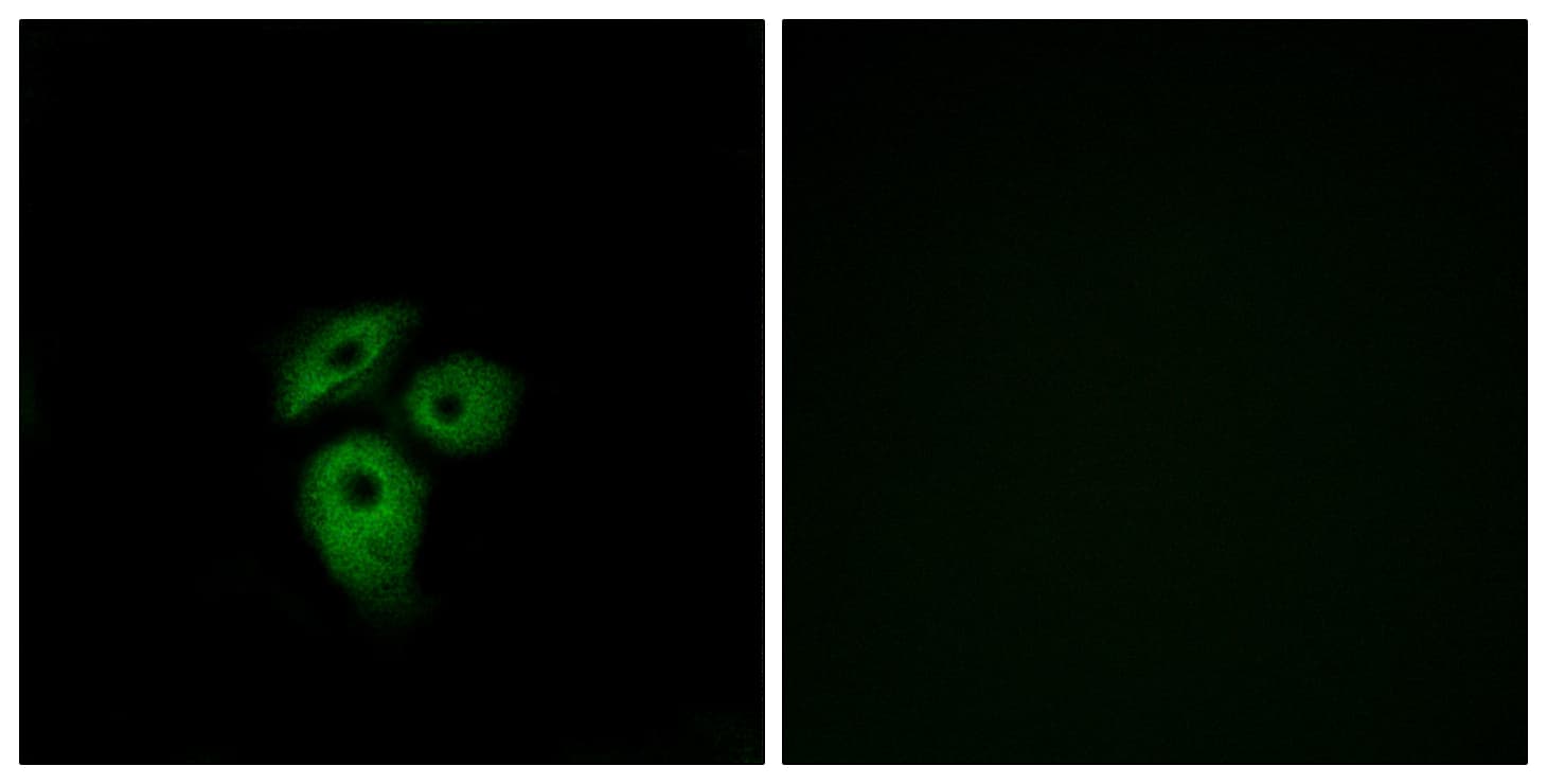 IHC-plus™ ACKR1 / DARC Antibody (aa1-50)