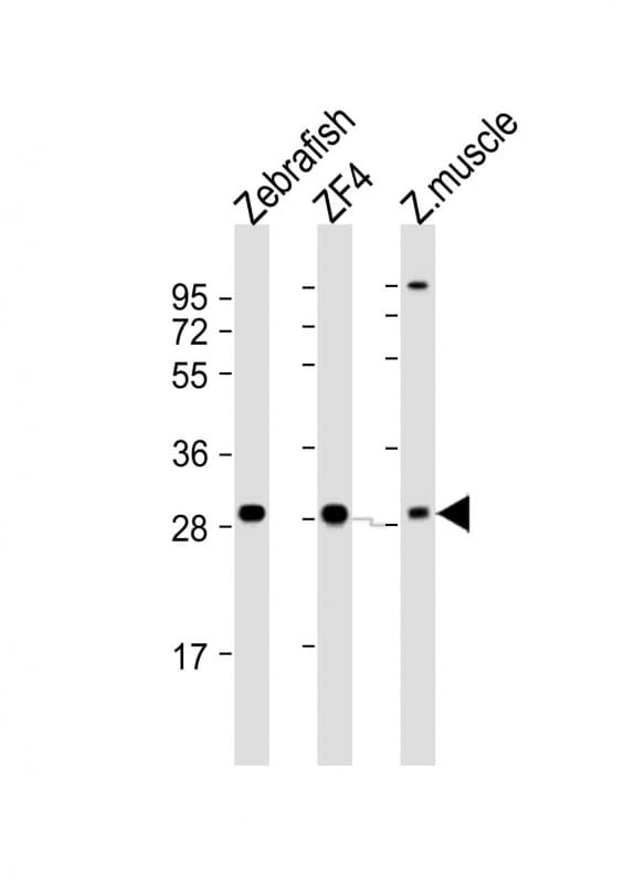 AK2 / Adenylate Kinase 2 Antibody (aa3-39)