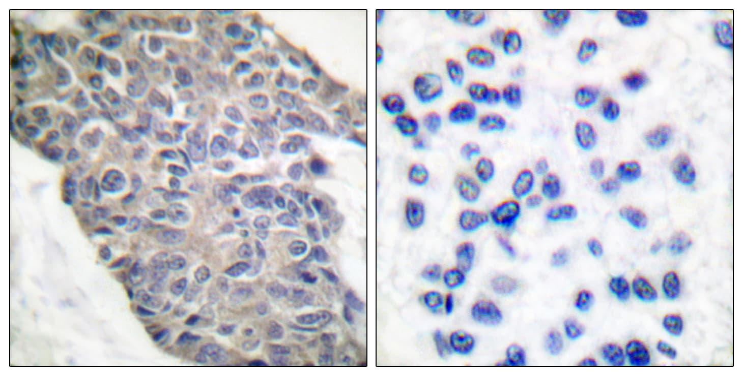 Polyclonal Rabbit anti-Human Synaptotagmin Antibody (aa176-225, IHC, WB)