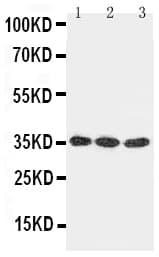 DKK1 Antibody (aa68-83)