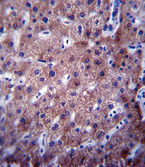 CYP2C19 Antibody (aa257-285)
