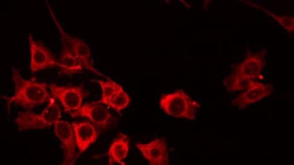 Polyclonal Rabbit anti-Human ACOT8 Antibody (IF, WB)