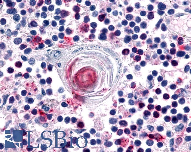 PathPlus™ Polyclonal Rabbit anti-Human CCR7 Antibody (N-Terminus, IHC)
