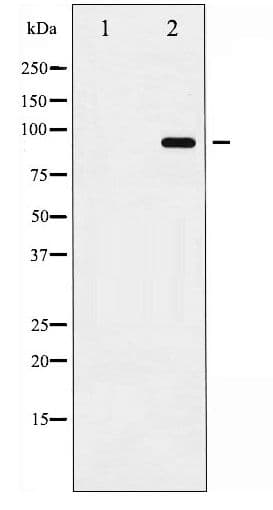 Polyclonal Rabbit anti-Human ADAM17 / TACE Antibody (phospho-Thr735, WB)