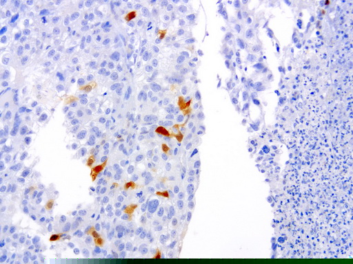 SERPINB4 / SCCA1+2 Antibody (clone UMAB16)