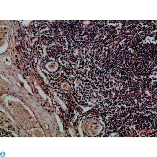 KIR2DL5A / KIR2DL5 Antibody