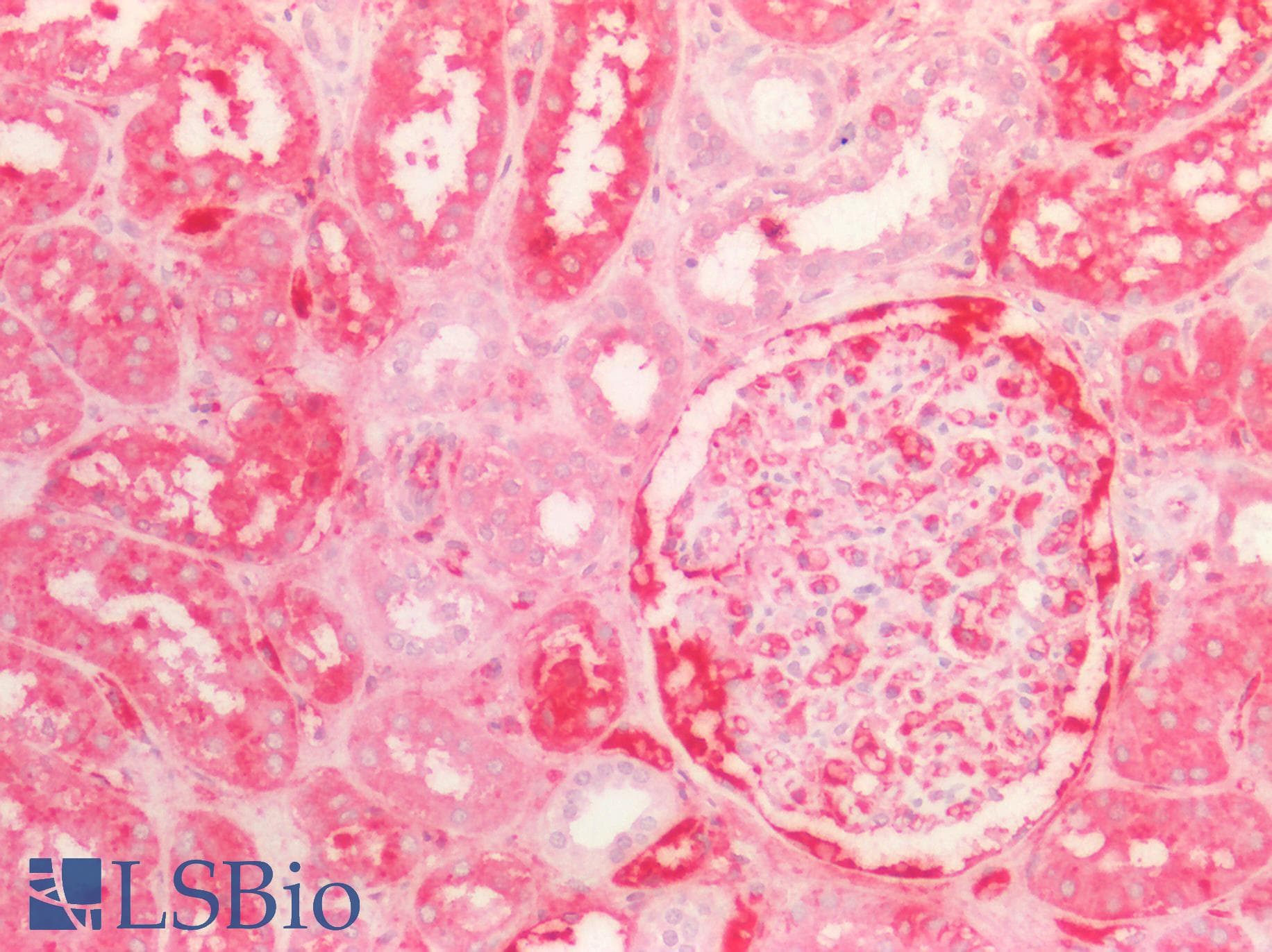 PathPlus™ KNG1 / Kininogen / Bradykinin Antibody (aa1-416)