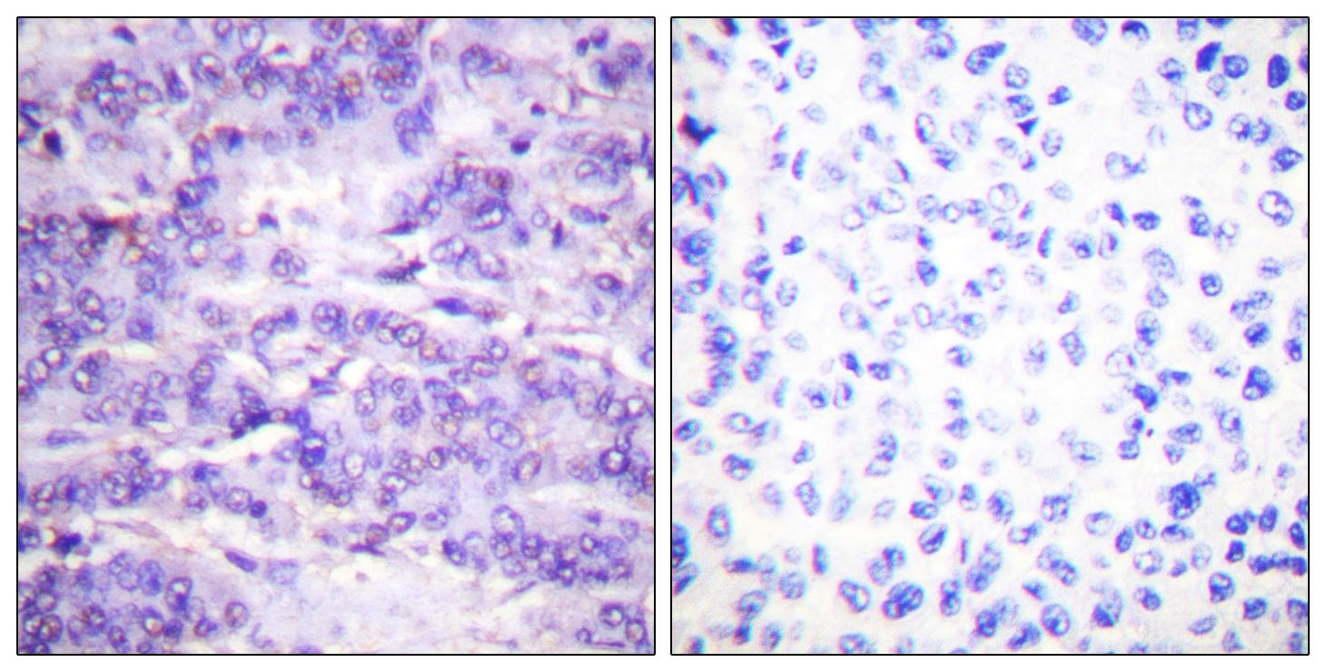 MDM2 Antibody (phospho-Ser166)