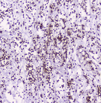 HMGN2 Antibody