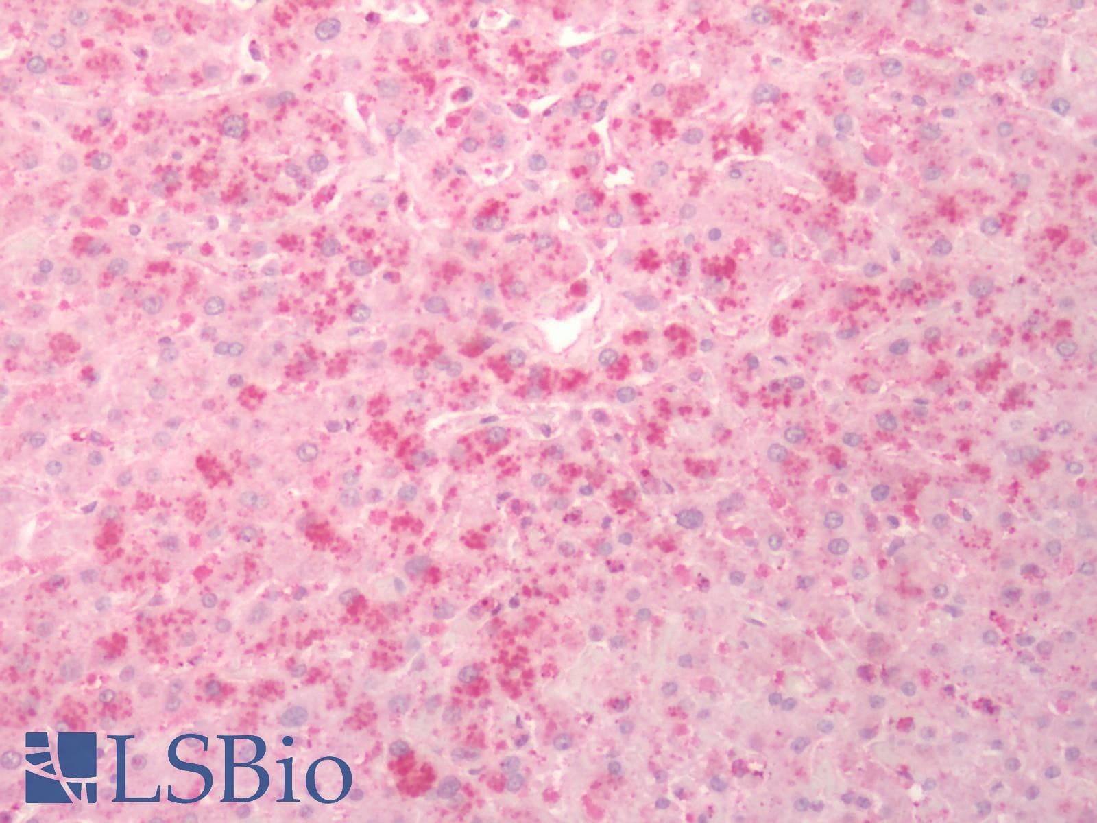 IHC-plus™ Polyclonal Rabbit anti-Human BACE1 / BACE Antibody (N-Terminus, IHC)