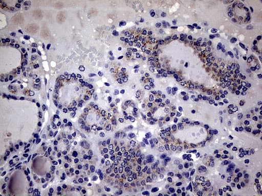 IL20 Antibody (aa25-176, clone OTI2B8)