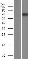 Human TBC1D17 Protein (Over-Expression Lysate Myc-DDK (Flag))