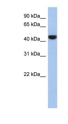 Polyclonal Rabbit anti-Human PRR30 Antibody (aa323-372, WB)