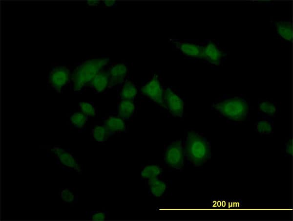 CDKN2AIP Antibody (clone 1A6)