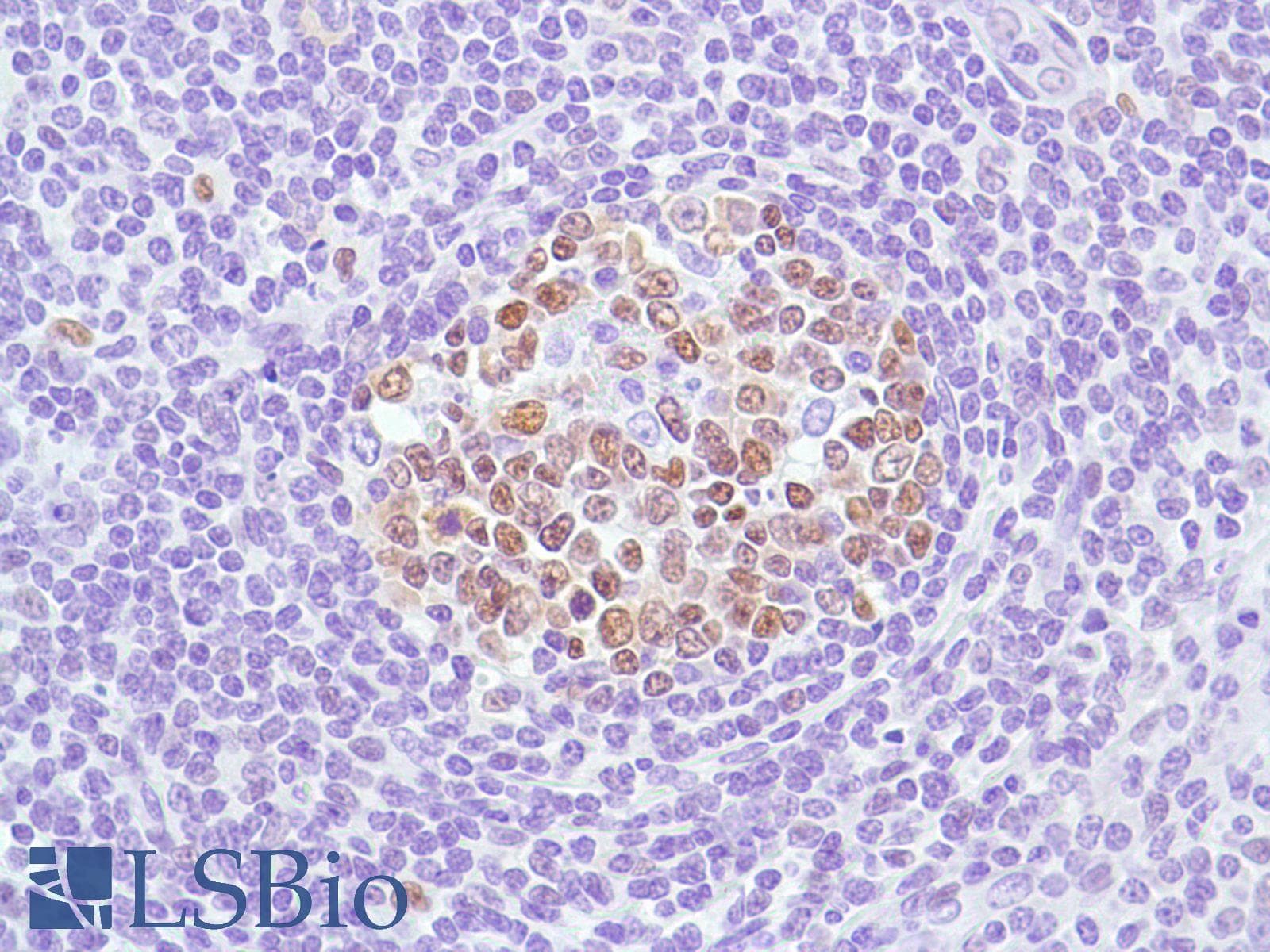 Monoclonal Rabbit anti-Human BCL6 Antibody (clone SP155, C-Terminus, IHC)