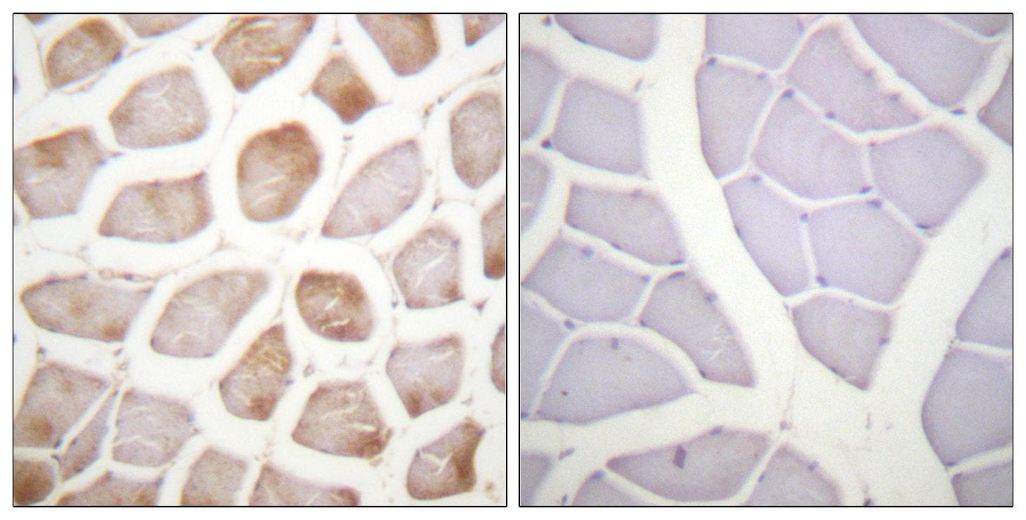 DAPK2 / DAP Kinase 2 Antibody (phospho-Ser318)