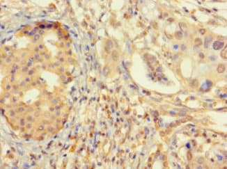 ZNF2 Antibody