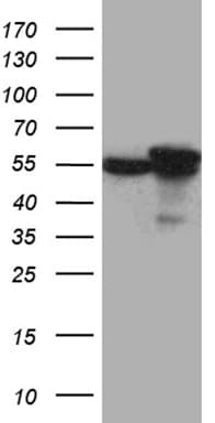 Monoclonal Mouse anti-Human CCT4 / SRB Antibody (clone OTI1A3, WB)