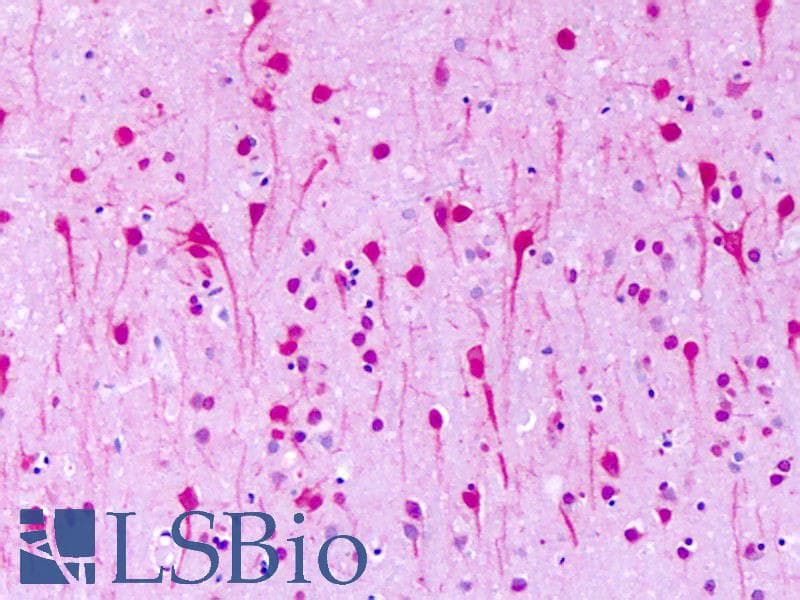 IHC-plus™ GPR1 Antibody (N-Terminus)