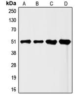 Polyclonal Rabbit anti-Human FLI1 Antibody (Internal, IHC, WB)