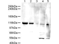 Polyclonal Rabbit anti-Human ATAD5 / ELG1 Antibody (WB)