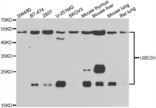 UBCH / UBE2H Antibody