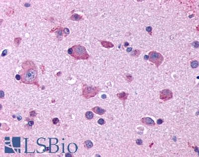 PathPlus™ HTR2B / 5-HT2B Receptor Antibody (Extracellular Domain)