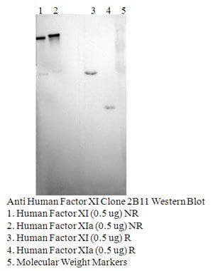 F11 / FXI / Factor XI Antibody (clone 2B11-E5F6)