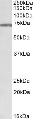 IHC-plus™ MLC1 / MLC Antibody (aa179-193)