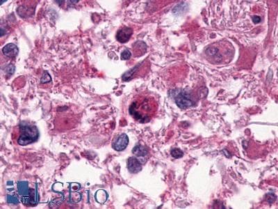 PathPlus™ Polyclonal Rabbit anti-Human LPAR1 / LPA1 / EDG2 Antibody (N-Terminus, IHC)