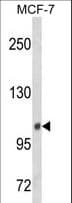 Polyclonal Rabbit anti-Human INPP4B Antibody (aa367-393, IHC, WB)