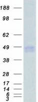 Human IFNGR2 Protein (Recombinant Myc-DDK (Flag))