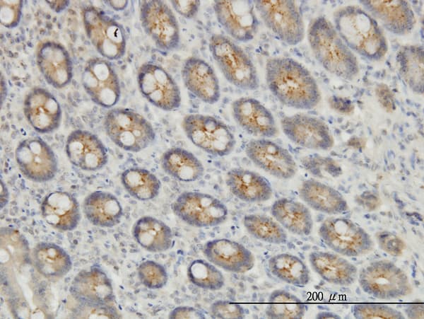 EXOC7 Antibody (clone 1D4)