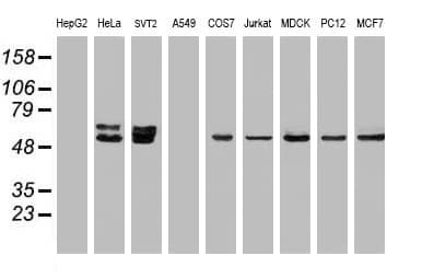 OXSR1 / OSR1 Antibody (clone OTI1F3)